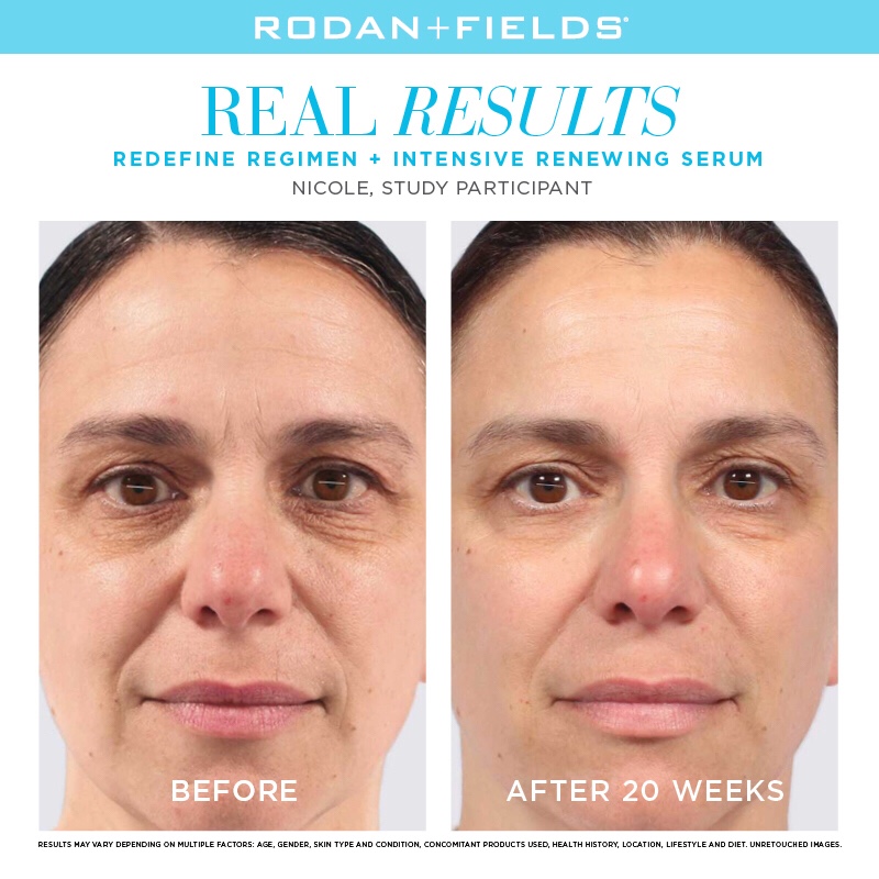 Rodan + Fields Before and After Photo Stories 